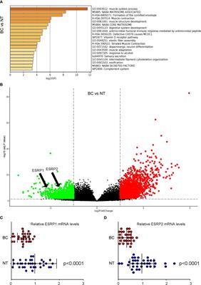 Downregulated ESRP1/2 promotes lung metastasis of bladder carcinoma through altering FGFR2 splicing and macrophage polarization